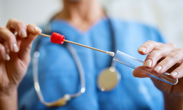 TEST MED BOMULLSPINNE: Testen er rask og enkel. Foto: NTB Scanpix/Shutterstock TEST MED BOMULLSPINNE: Testen er rask og enkel. Foto: NTB Scanpix/Shutterstock